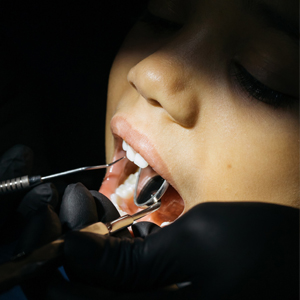 4 Kids Dental Procedures | Pediatric Dentist Rancho Cucamonga